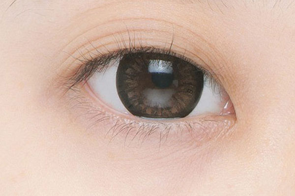 Mắt ba mí và cách điều chỉnh về mắt hai mí 1